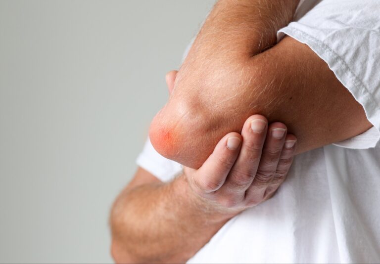 Elbow