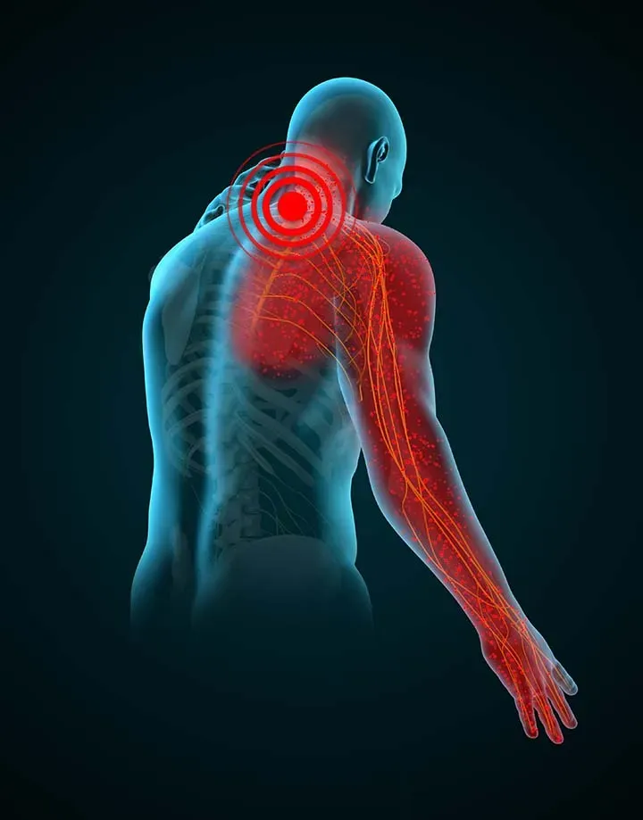 Dislocations