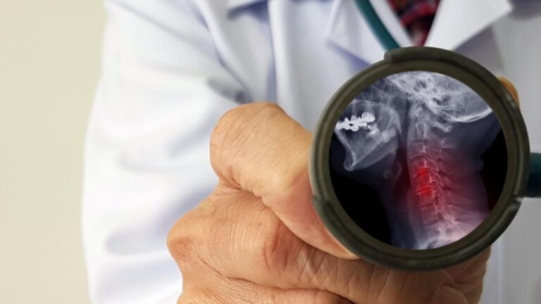 Herniated disc