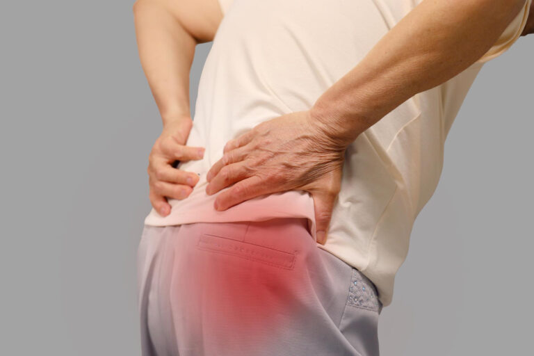 Sciatica
