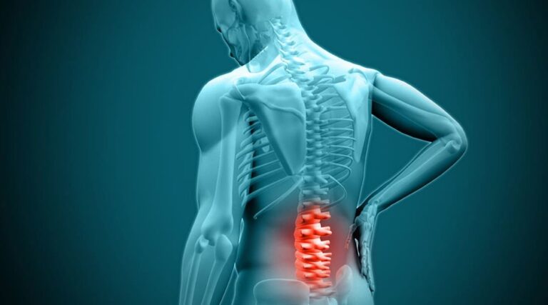 Herniated/Slipped Disc