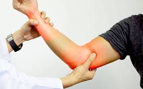 Stiff ligaments