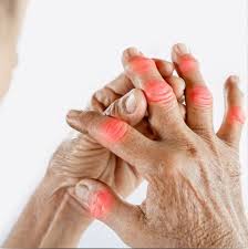 Autoimmune Response